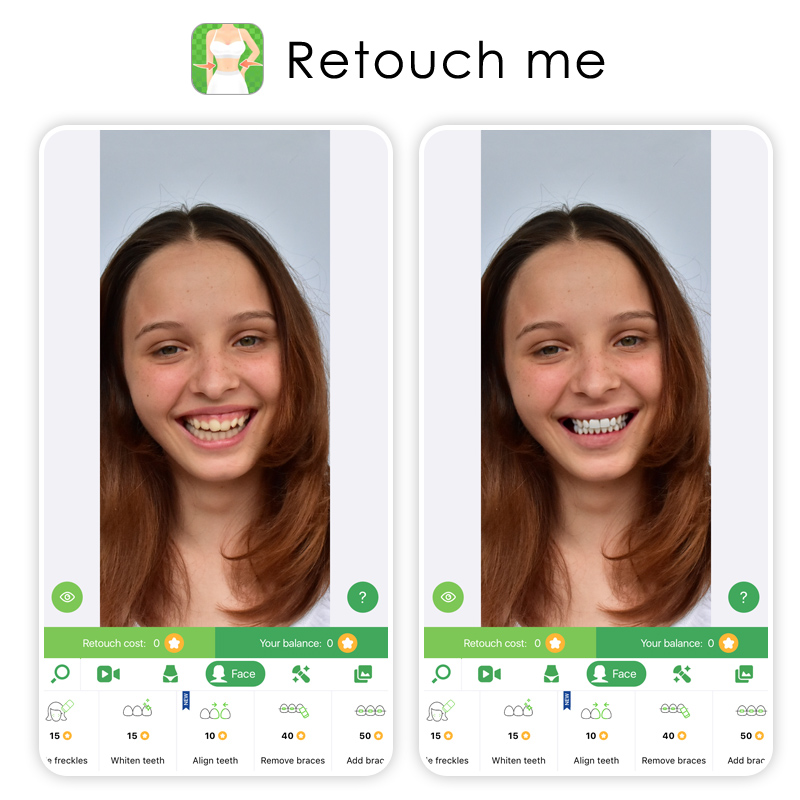 RetouchMe: категория Face и услуга Whiten teeth в мобильном интерфейсе
