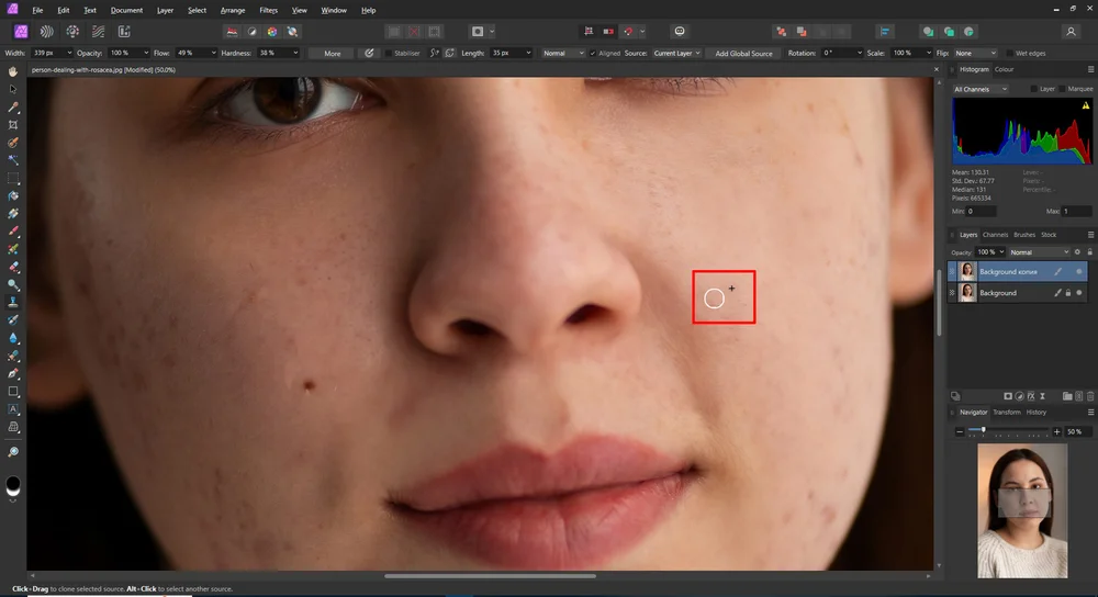 Удаление локального дефекта в Affinity Photo